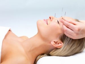 cosmetische acupunctuur Leidschendam Voorburg