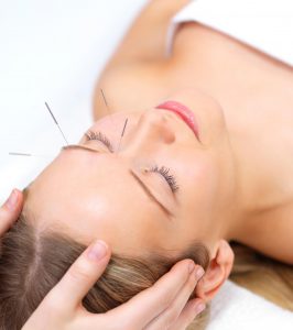 cosmetische acupunctuur